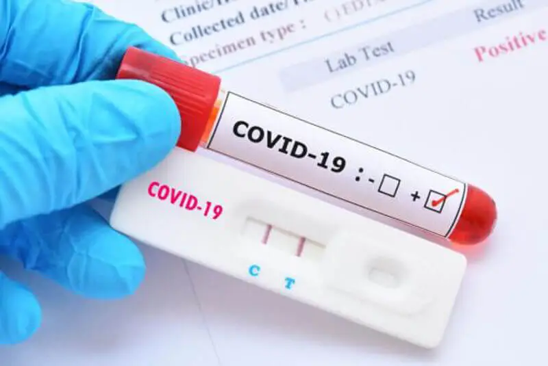 When Is a Covid Test Required Life Aid